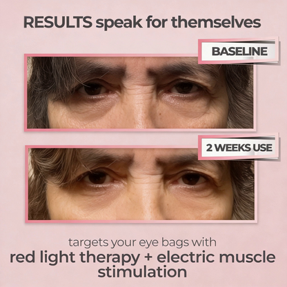 luminien™ Eye Bag Therapy