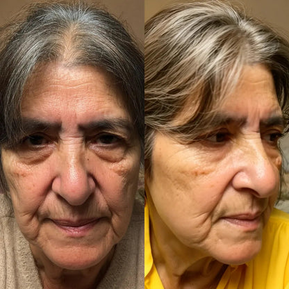 luminien™ Eye Bag Therapy